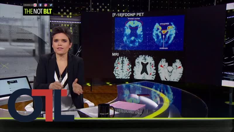 OTL responds to NFL concussion coverage claims, Outside The Lines,