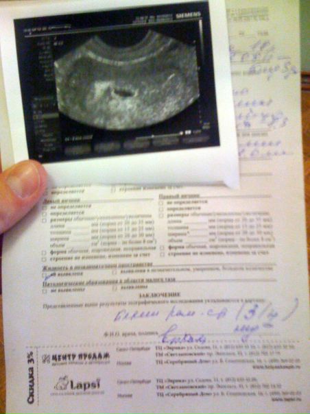 №43, Никита Ишин, 34 года, Санкт-Петербург №43, Никита Ишин, 34 года, Санкт-Петербург