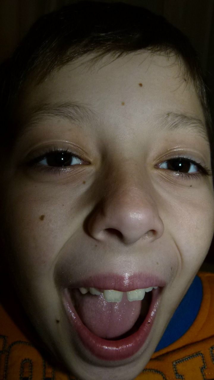 Дмитрий Тищенко | Бахчисарай