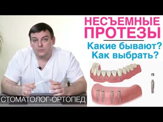 Несъемные зубные протезы: какие бывают и как выбрать несъемный протез для зубов Зубные мосты и др.