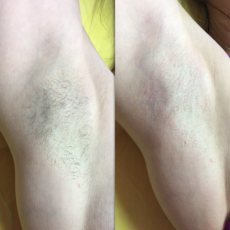 Елена Киселёва | Санкт-Петербург