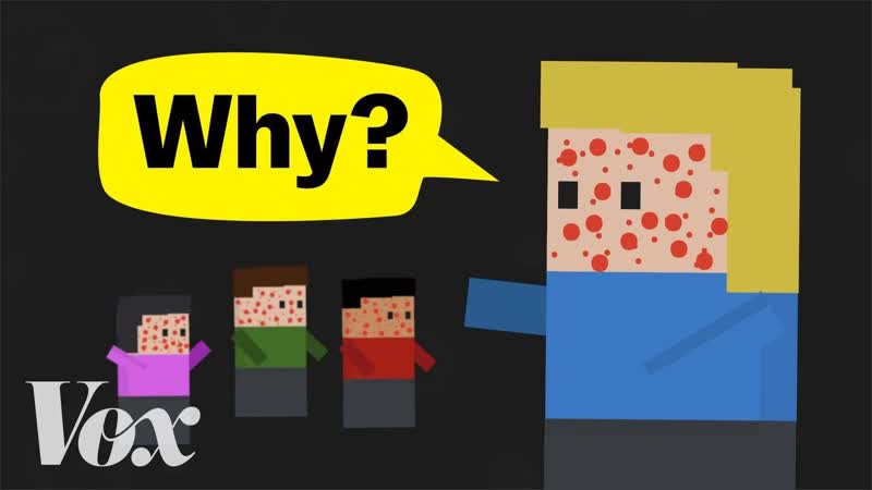 Why measles is back in the