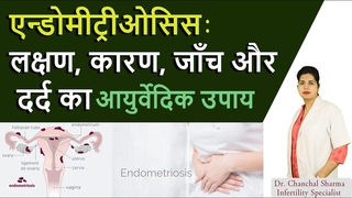Endometriosis: Symptoms, causes, Pain relief, Diagnosis and Ayurvedic Treatment - Aasha Ayurveda